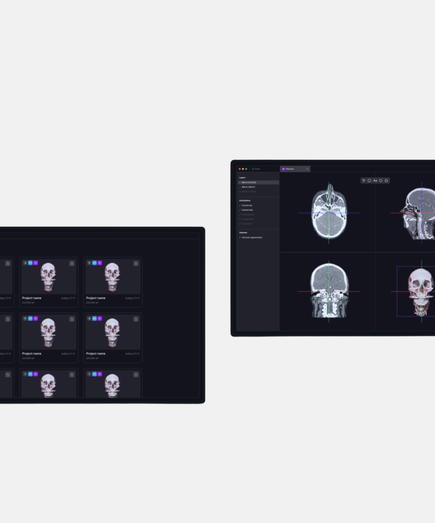 Neurotech