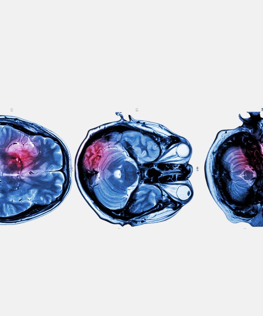 Medical imaging and nuclear medicine